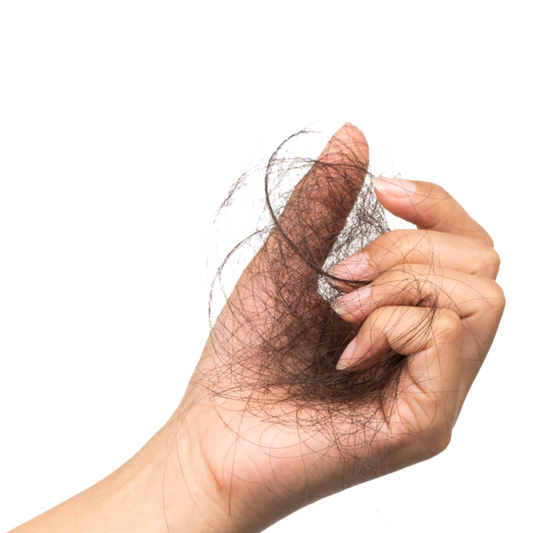 Polycystic Ovary Syndrome (PCOS) and hair loss